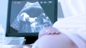 超声波扫描中的婴儿图片 孕妇胃前方