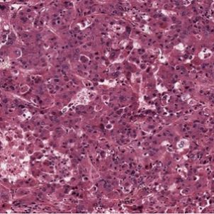 肝细胞癌新靶点及细胞系照片